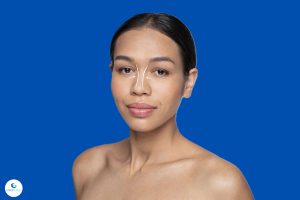 Tipos de rinoplastia ¿Cuál es mejor Diferencias y resultados